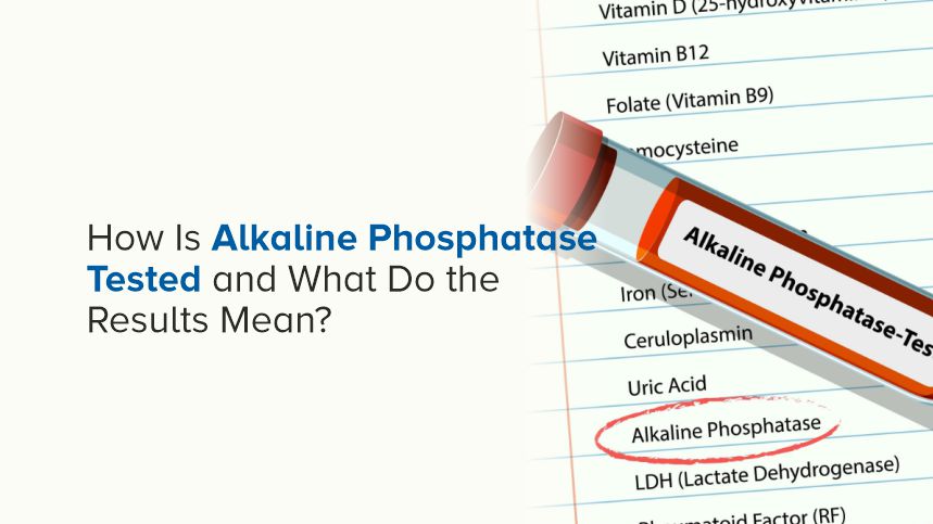 How Is Alkaline Phosphatase Tested and What Do the Results Mean?
